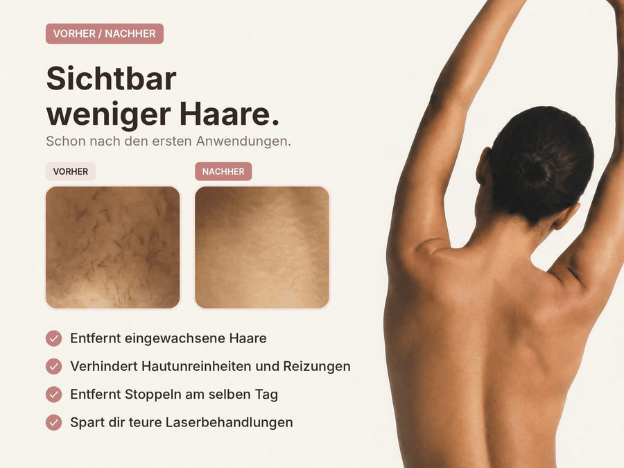 Vorher-Nachher: Haarreduktion nach mehreren Wochen IPL-Anwendung