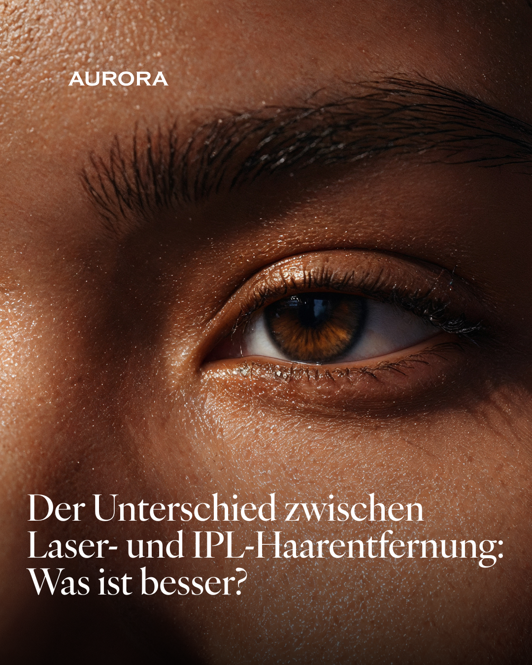 Der Unterschied zwischen Laser- und IPL-Haarentfernung: Was ist besser?