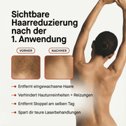 PureSkin Ultra 9 - AURORA