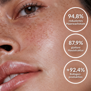 AURORA® PureSkin Ultra 9 – 3-in-1 IPL-Gerät