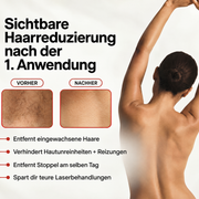 AURORA® PureSkin Ultra 9 – 3-in-1 IPL-Gerät