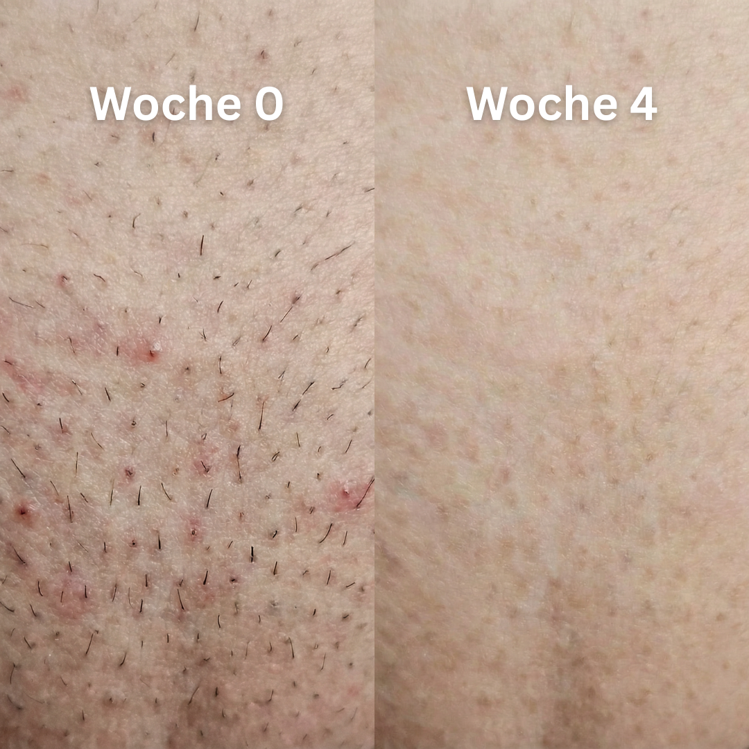 Before - Slide 3