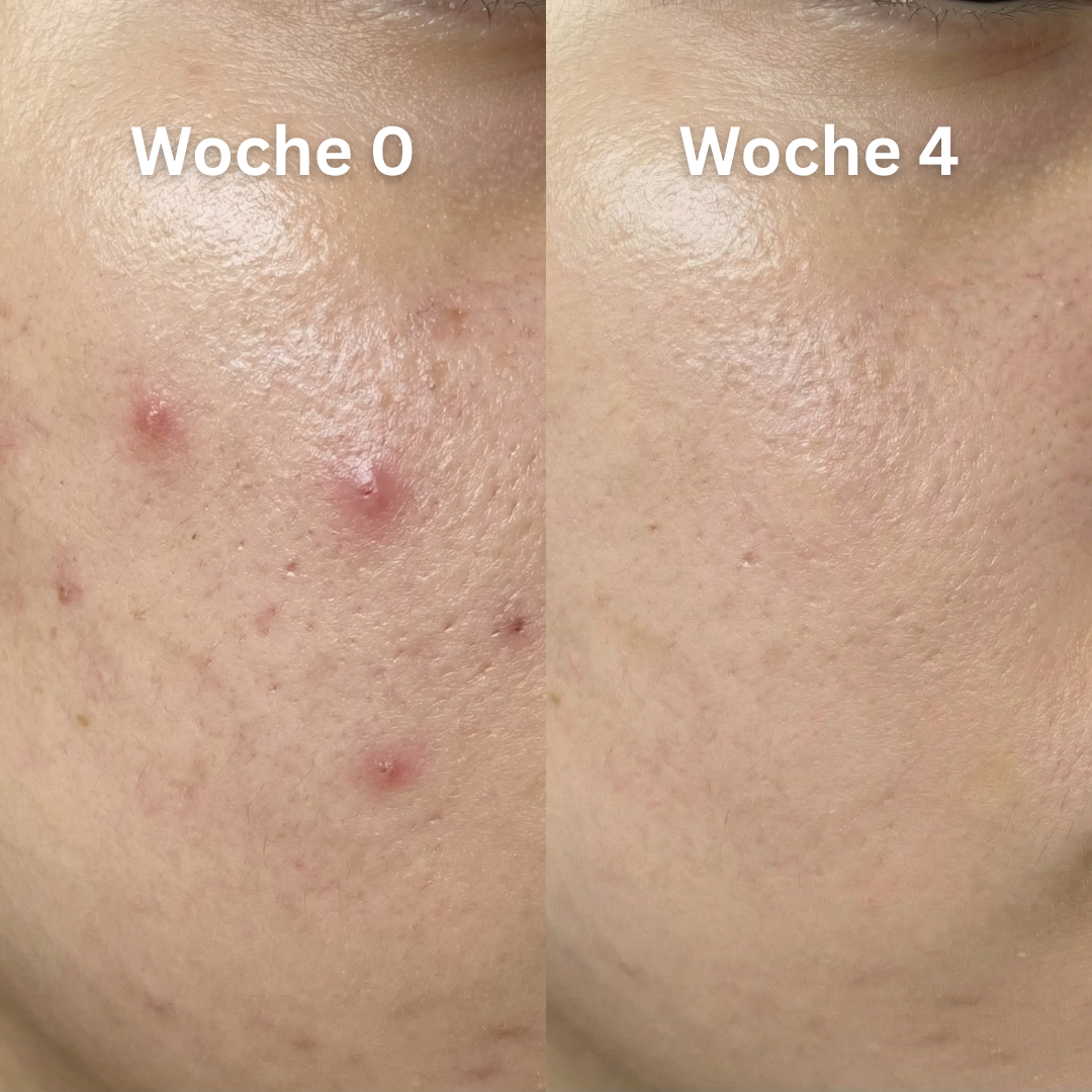 Before - Slide 1