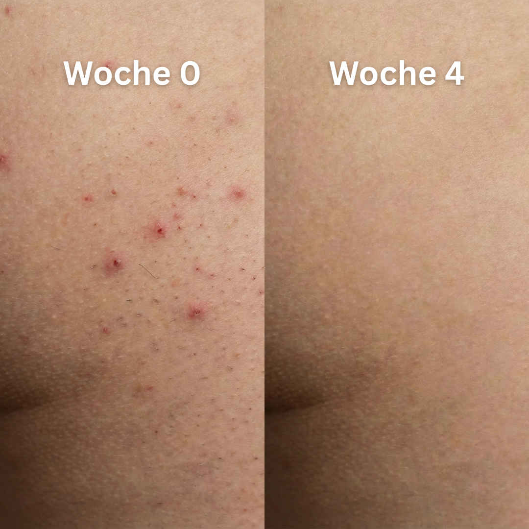 Before - Slide 3