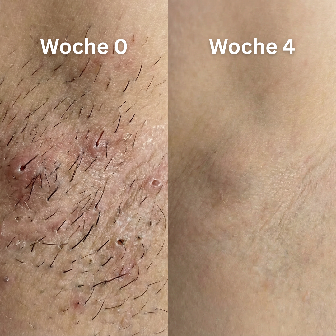 Before - Slide 1